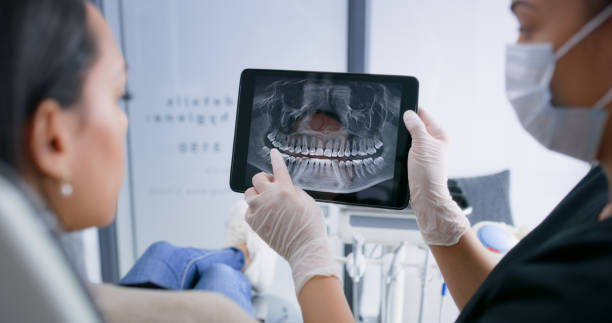 Licensed Tooth Extraction service in Springville, UT - Smile Center Dentistry
